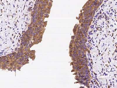 Immunohistochemistry-Paraffin: CORO1B Antibody [NBP2-98597]