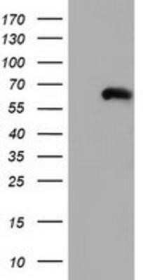 Western Blot: CORO1B Antibody (OTI3D10)Azide and BSA Free [NBP2-72086]