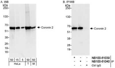 Western Blot: CORO1B Antibody [NB100-61040]