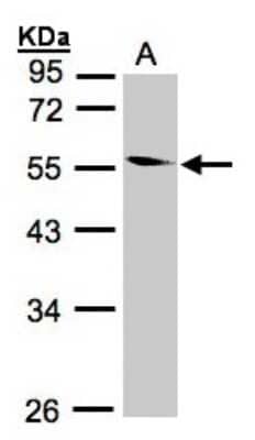 Western Blot: CORO1B Antibody [NBP1-32514]