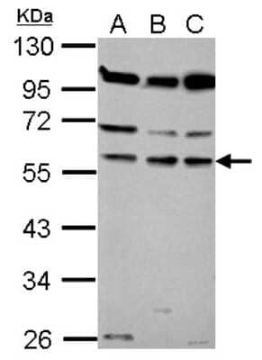 Western Blot: CORO1B Antibody [NBP2-15965]