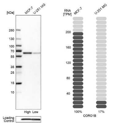 Western Blot: CORO1B Antibody [NBP2-49634]