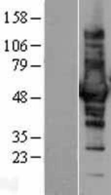 Western Blot: CORO1B Overexpression Lysate [NBL1-09396]