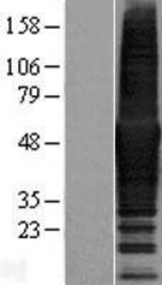 Western Blot: CORO1B Overexpression Lysate [NBP2-08677]