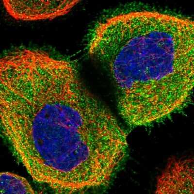 Immunocytochemistry/ Immunofluorescence: CORO2A Antibody [NBP1-81582]