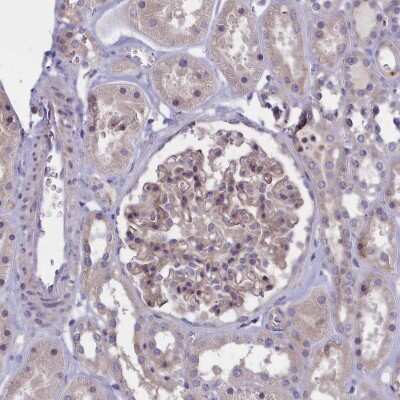 Immunohistochemistry-Paraffin: CORO2A Antibody [NBP1-81582]