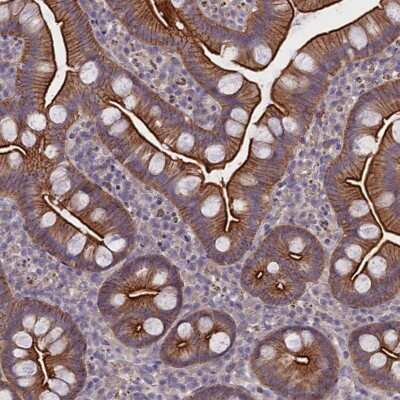 Immunohistochemistry-Paraffin: CORO2A Antibody [NBP1-81582]