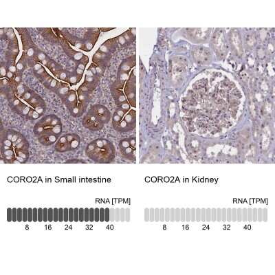 Immunohistochemistry-Paraffin: CORO2A Antibody [NBP1-81582]