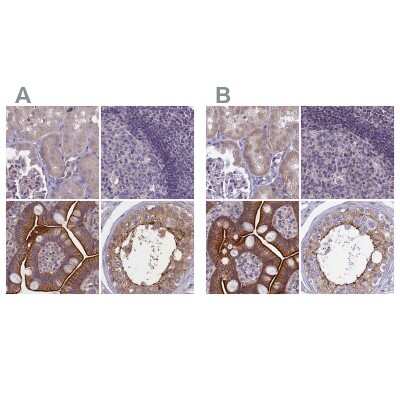 Immunohistochemistry-Paraffin: CORO2A Antibody [NBP1-81582]