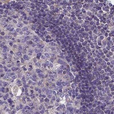 Immunohistochemistry-Paraffin: CORO2A Antibody [NBP1-81582]