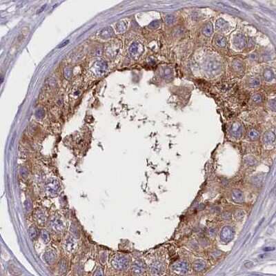 Immunohistochemistry-Paraffin: CORO2A Antibody [NBP1-81582]