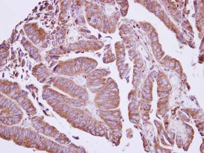 Immunohistochemistry-Paraffin: CORO2A Antibody [NBP2-15966]