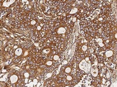 Immunohistochemistry-Paraffin: CORO2A Antibody [NBP2-99188]