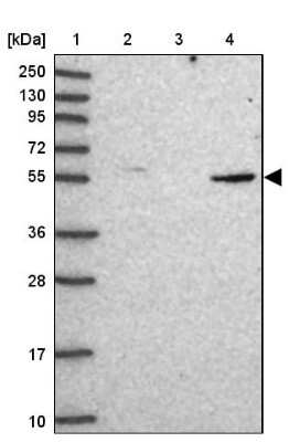 Western Blot: CORO2A Antibody [NBP1-81583]