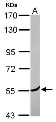 Western Blot: CORO2A Antibody [NBP2-15966]