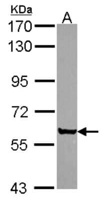 Western Blot: CORO2A Antibody [NBP2-15967]