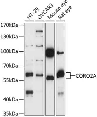 Western Blot: CORO2A AntibodyAzide and BSA Free [NBP2-92169]