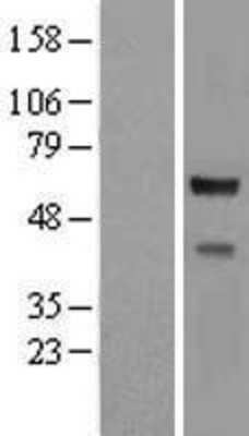 Western Blot: CORO2A Overexpression Lysate [NBL1-09399]