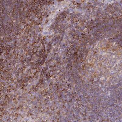 Immunohistochemistry-Paraffin: CORO7 Antibody [NBP2-33687]