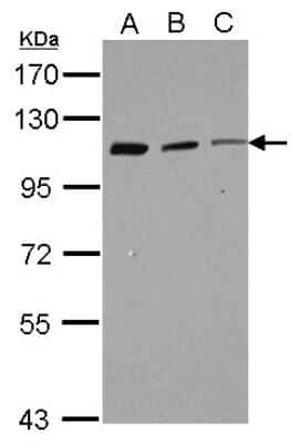 Western Blot: CORO7 Antibody [NBP2-14916]