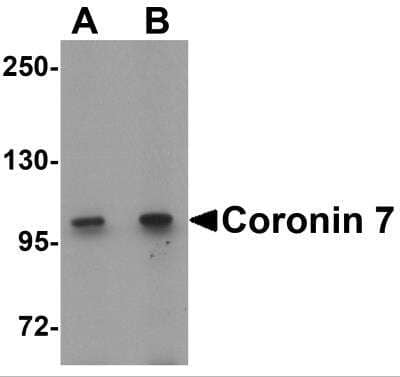 Western Blot: CORO7 AntibodyBSA Free [NBP2-81790]