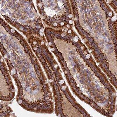 Immunohistochemistry-Paraffin: CORO7 Antibody [NBP1-93946]