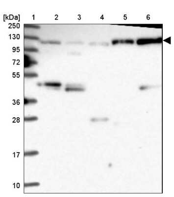 Western Blot: CORO7 Antibody [NBP1-93946]