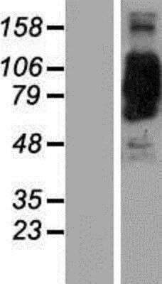 Western Blot: CORO7 Overexpression Lysate [NBP2-06324]