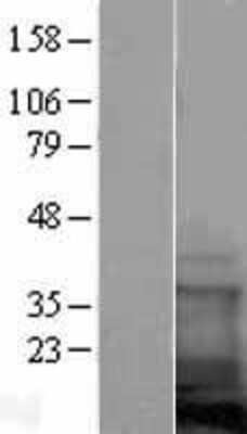 Western Blot: Coactosin-like Protein 1/CotL1 Overexpression Lysate [NBL1-09402]