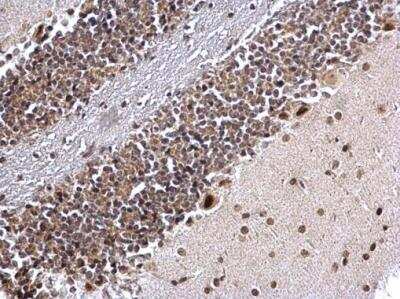 Immunohistochemistry-Paraffin: COUP-TF I/NR2F1 Antibody [NBP1-31259]