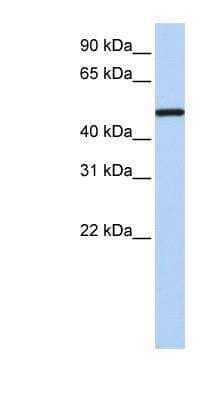 Western Blot: COUP-TF I/NR2F1 Antibody [NBP1-52825]