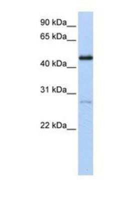 Western Blot: COUP-TF I/NR2F1 Antibody [NBP1-52831]