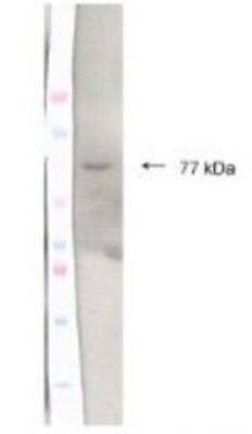 Western Blot: COUP-TF I/NR2F1 Antibody [NBP1-52831]