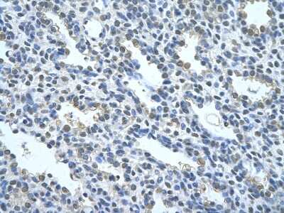 Immunohistochemistry-Paraffin: COUP-TF II/NR2F2 Antibody [NBP3-10876]