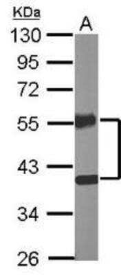 Western Blot: COUP-TF II/NR2F2 Antibody [NBP1-31980]