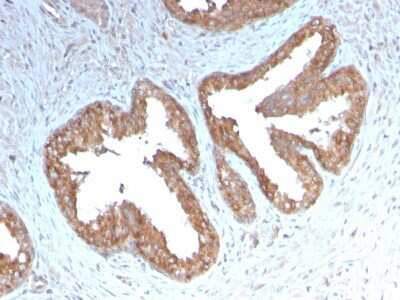 Immunohistochemistry-Paraffin: COX-2 Antibody (COX2/3232R) - Azide and BSA Free [NBP3-08273]