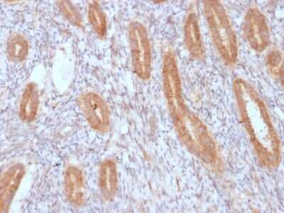 Immunohistochemistry-Paraffin: COX-2 Antibody (COX2/3232R) - Azide and BSA Free [NBP3-08273]