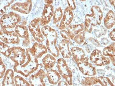 Immunohistochemistry-Paraffin: COX-2 Antibody (COX2/3320R) - Azide and BSA Free [NBP3-08301]