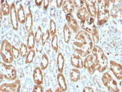 Immunohistochemistry-Paraffin: COX-2 Antibody (COX2/3320R) - Azide and BSA Free [NBP3-08301]