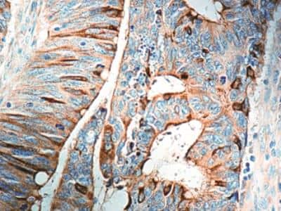 Immunohistochemistry-Paraffin: COX-2 Antibody [NB100-689]