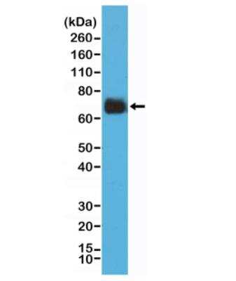 Western Blot: COX-2 Antibody (RM348) [NBP2-77419]