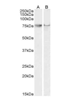 Western Blot: COX-2 Antibody [NB100-868]