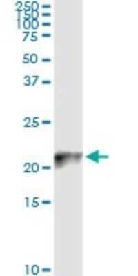 Immunoprecipitation: COX IV Isoform 2 Antibody (1F2) [H00084701-M01]