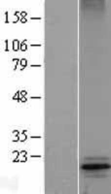 Western Blot: COX4 Overexpression Lysate [NBL1-09409]