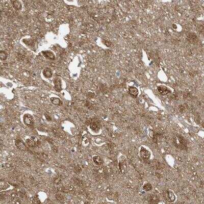 Immunohistochemistry: COX10 Antibody [NBP1-86323]