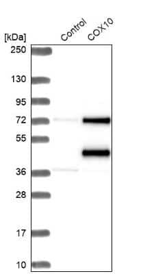 Western Blot: COX10 Antibody [NBP1-86322]