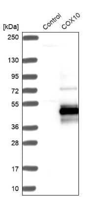 Western Blot: COX10 Antibody [NBP1-86323]