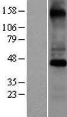 Western Blot: COX10 Overexpression Lysate [NBP2-08219]