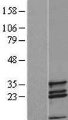 Western Blot: COX11 Overexpression Lysate [NBL1-09404]