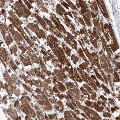 Immunohistochemistry: COX15 Antibody [NBP1-85880]